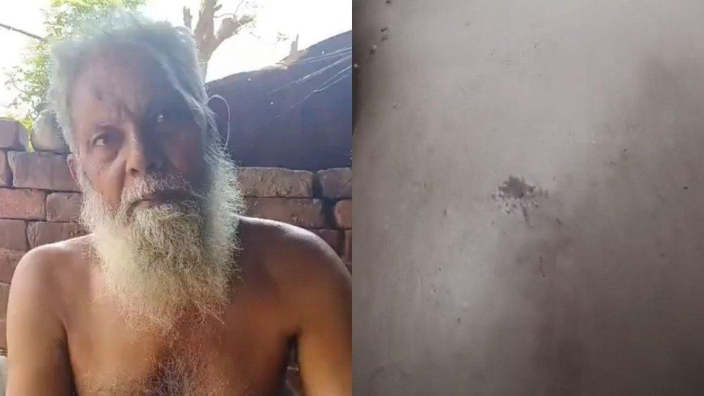 Elderly Muslim Hawker Allegedly Assaulted, Robbed in UP’s Pratapgarh; Victim Says He Was Told to ‘Go to Pakistan’