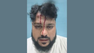 Bihar Man Alleges Religious Assault on UP Train; Says Attackers Targeted Him for Beard and Skullcap