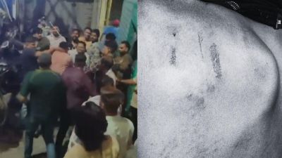 Muslim Family in Delhi's Shakurpur Claims Violent Mob Attack After Rickshaw Dispute, Pregnant Woman Alleges Rape Threats
